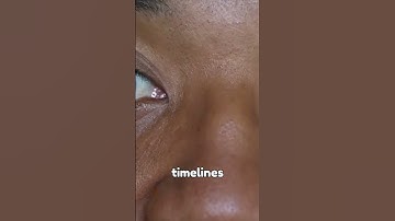 Why Do We Get Dejavu?