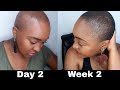 BALD HEAD SCALP CARE | Wash Routine | Hair Growth | YemuDaily