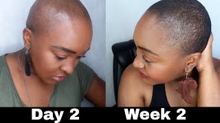 BALD HEAD SCALP CARE | Wash Routine | Hair Growth | Yemu