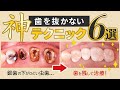 札幌市の歯医者「ユアーズデンタル クリニック」歯を抜かない神テクニック6選