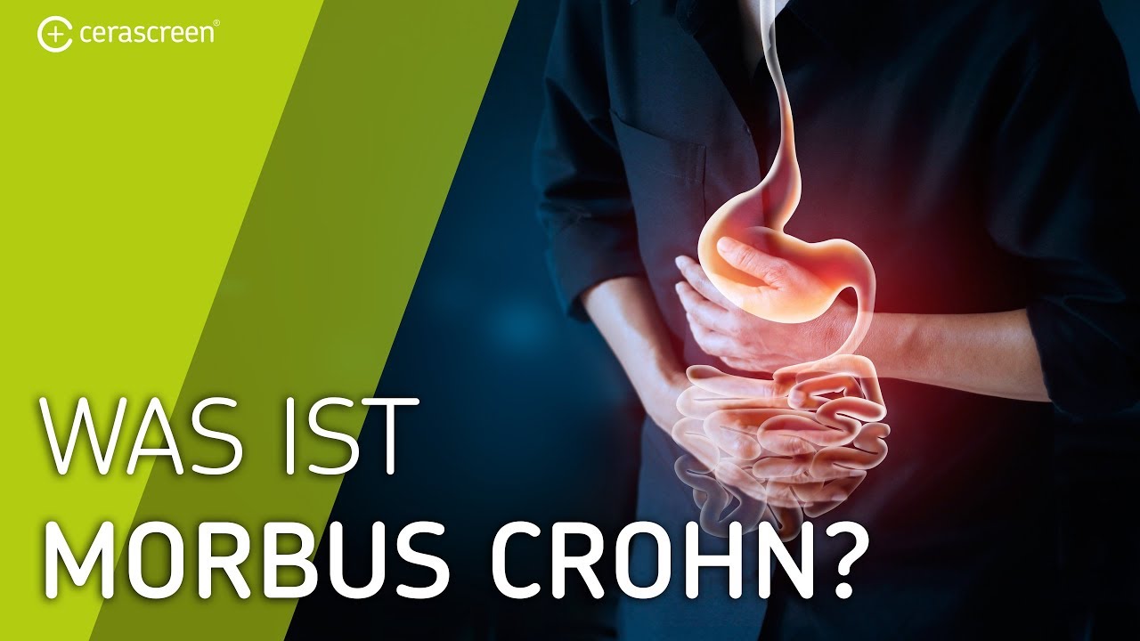Morbus Crohn Vererbbar Morbus Crohn Vererbbar