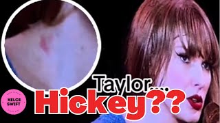 Taylor Swift appears to have a HICKEY on her neck during Stockholm Eras Tour after Italy getaway by Kelce Swift 843 views 22 hours ago 1 minute, 33 seconds