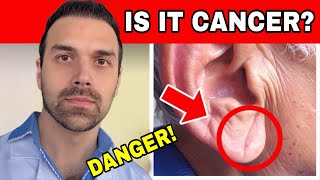 If You Have ANY of These 7 SIGNS, It Could Be CANCER or a SERIOUS DISEASE! See a DOCTOR IMMEDIATELY