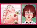 ASMR Teacher S Foot Corns Calluses And Blisters Removal Satisfying ASMR Animation ASMR Teacher S Foot Corns Calluses And Blisters Removal Satisfying ASMR Animation