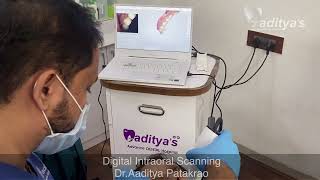 Digital Intraoral Scanning By Dr Aaditya Patakrao