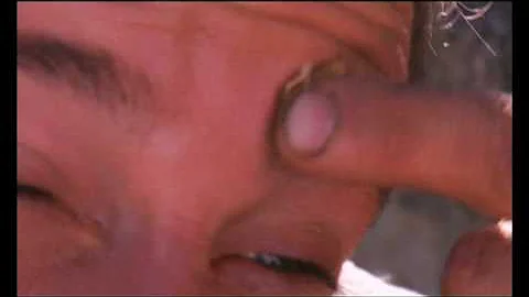 Born Survivor - Bee Sting