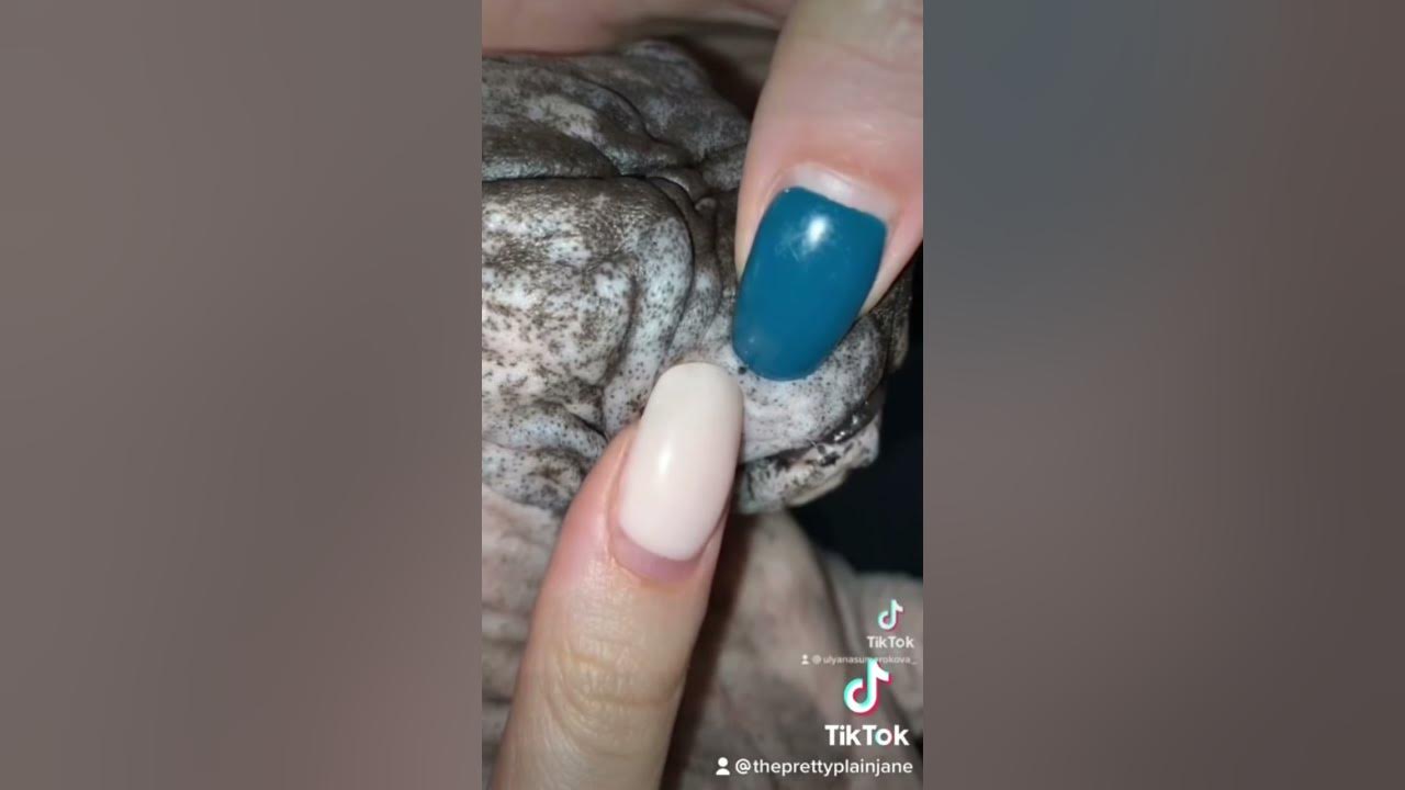 Blackhead on a cat pimple medical pimplepopper cyst pimplepopping