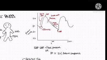 Arterial waveforms