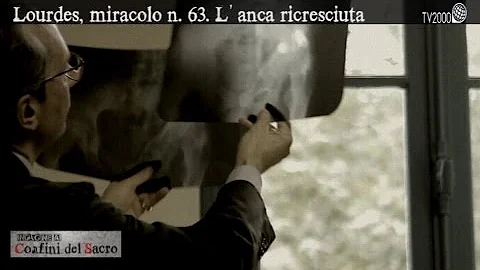 Quanti sono i miracoli di Lourdes?