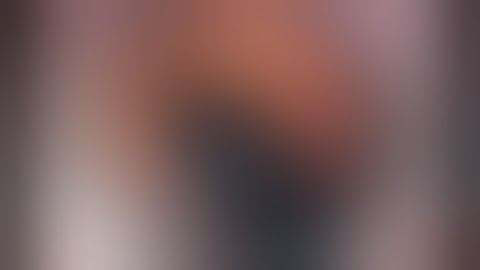 Iris coloboma:  laser cataract surgery + artificial iris (Morcher) & toric IOL - Dr Simon Chen HD