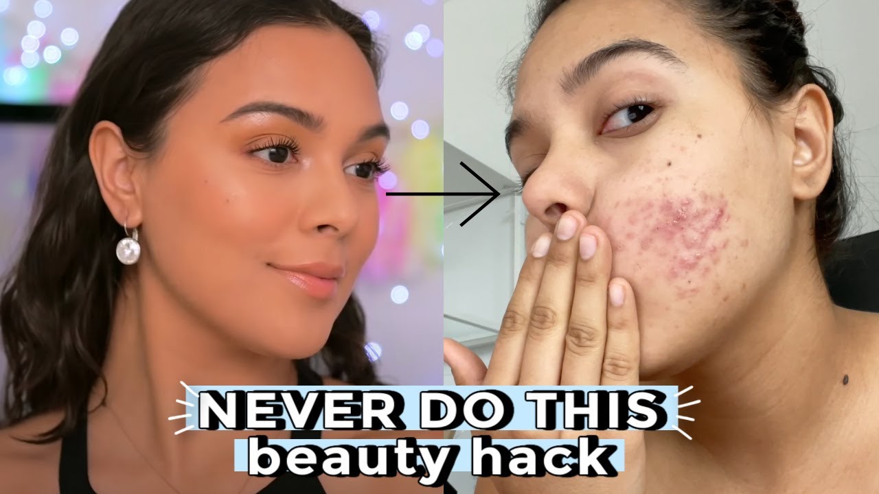 I ruined my face with this beauty hacknever do this. 