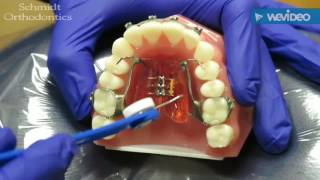 Expander Tutorial
