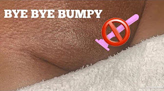 use coconut oil to get rid of razor bumps and scarring - YouTube use coconut oil to get rid of razor bumps and scarring - YouTube