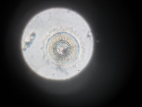 Инфузория триходина (Trichodina sp.), возбудитель триходиноза аквариумных рыб