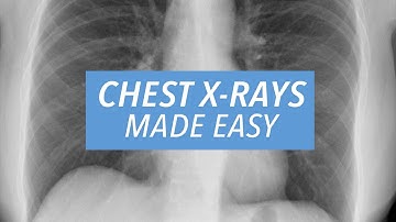 Chest X-Rays Made Easy: Learn to Read a CXR in 10 Minutes