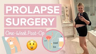 My (POP) Experience VLOG: 1 Week Post Op Update - Undefining Motherhood Wealth