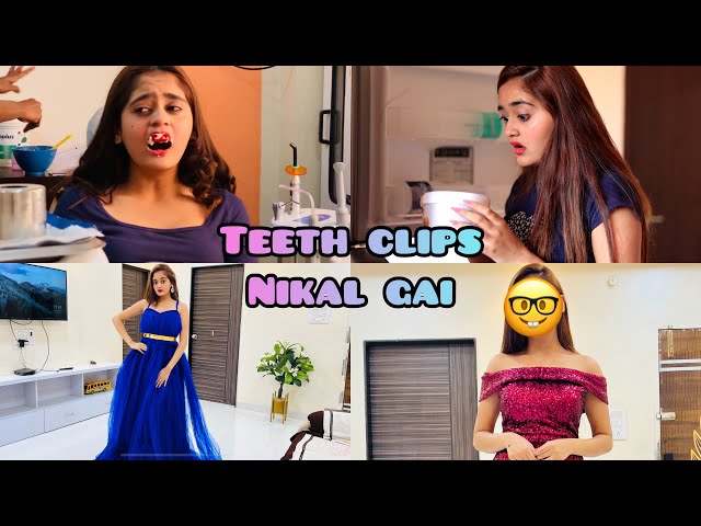 OMG! Finally Teeth Clips Nikal Gaye😍Before Valentine Day Celebrations 🥺 How Bindass Kavya Look Now class=