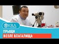 😱 Прыщи возле влагалища. Клинический случай №341