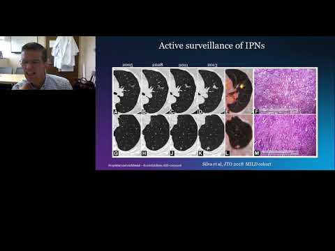 How do we bring lung cancer diagnostic biomarkers to the clinic?