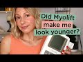 Myolift Mini 60-Day Results - Before & After Photos | Skin Obsessed Mary