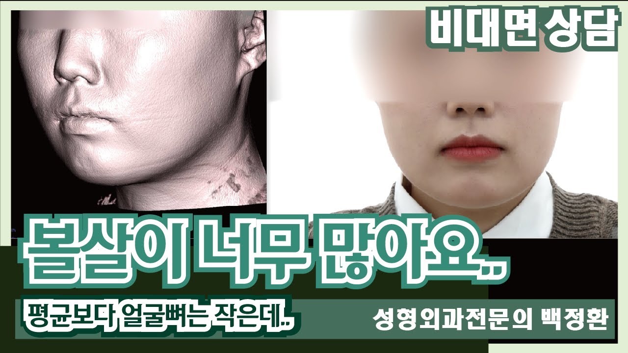 (SUB) 얼굴뼈는 평균보다 작은데 U자형 얼굴 / 볼살이 현재 너무 많아요...  [비대면상담 #107] / I have too much cheek fat right now...