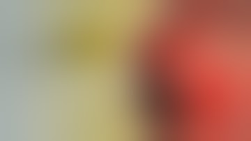 OTSC®neo System | Duodenal ulcer bleeding