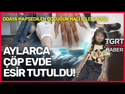 Çöp Evde Dram Türkiye’yi Ayağa Kaldırdı! Aylarca Esir Tutulan Çocuk Böyle Bulundu!