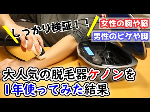 人気の脱毛器ケノンをこれから買う方に！！1年ガチ検証の結果と感想教えます！【KENON】