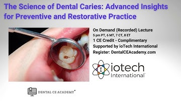 Free CE Webinar: Science of Dental Caries. Advanced Insights for Restorative & Preventive Practice.