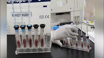 Erythrocyte Sedimentation Rate (ESR)