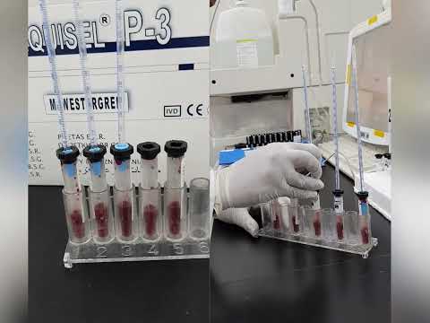 Erythrocyte Sedimentation Rate