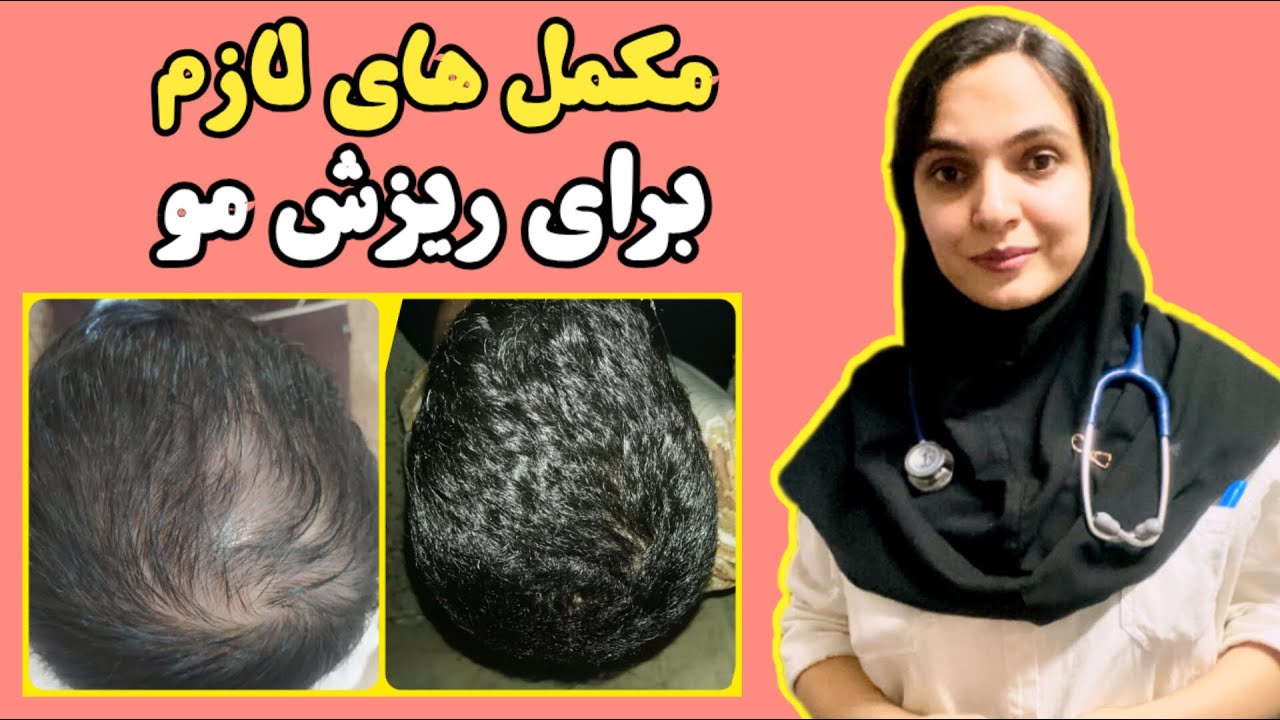 ریزش مو داری و نمیدونی چه مکمل هایی استفاده کنی ؟ اینجا توصیه علم پزشکی رو یاد بگیر