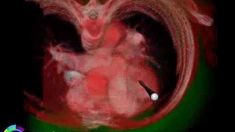 Haptic Rendering of Dynamic Volumetric Data