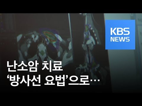 재발 많은 난소암…‘방사선 요법’ 치료로 잡는다 / KBS뉴스(News)
