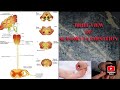 BRIEF VIEW OF SENSORY EXAMINATION _MADE EASY