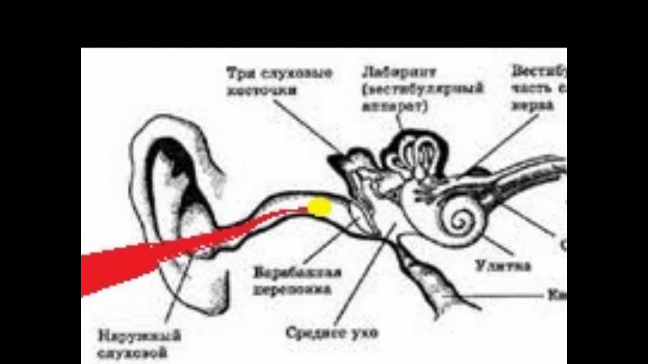 Что делать если в ухе застряла вода