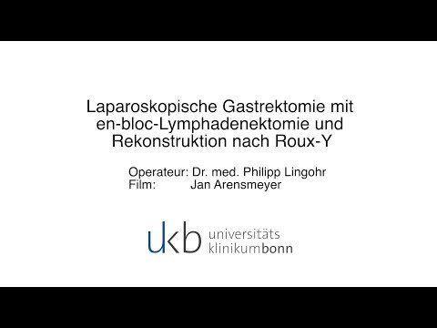 Gastrektomie (Chirurgie UKB)