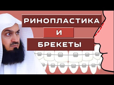 Изменение формы носа и зубов в Исламе | Муфтий Менк | Ринопластика и Брекеты