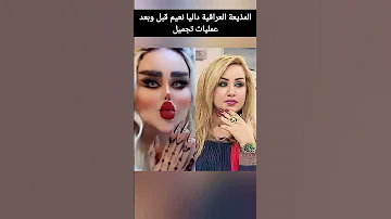 المذيعة العراقية داليا نعيم قبل وبعد عمليات تجميل 