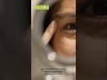 Cómo eliminar las ojeras - #ContornoDeOjos #VitaminaC #CafeínaParaLaPiel #SkinCareTips #AntiOjeras