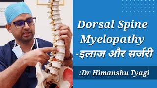 Dorsal Spine Myelopathy क्या होती है ?(इलाज और सर्जरी). Compressive dorsal Myelopathy. screenshot 1