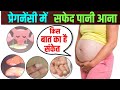 प्रेगनेंसी में सफेद पानी आना किस बात का है संकेत | White Discharge Kyu Hota Hai Pregnancy Me