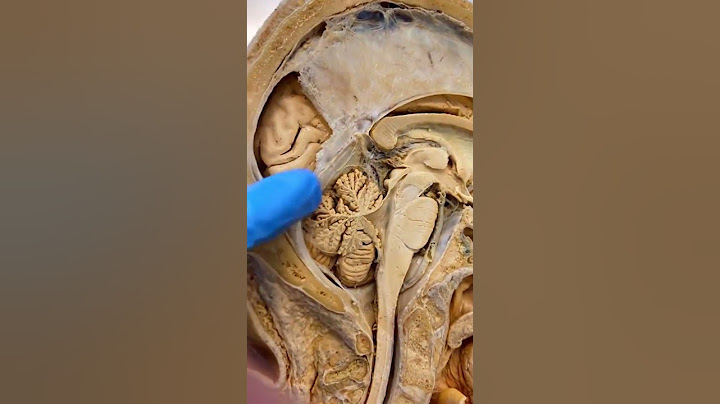 Esto es lo que conecta ambos lados de tu cerebro.. #shorts
