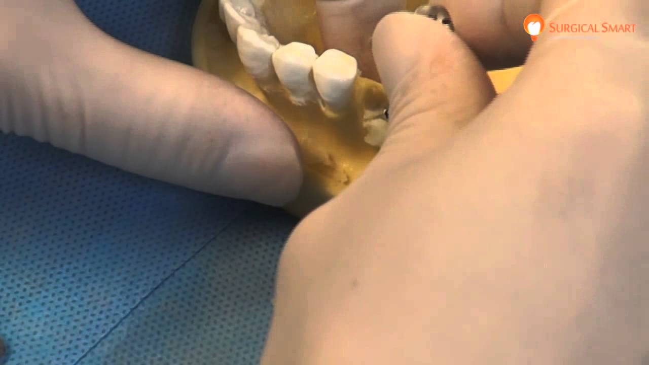 Surgical Smart SmartBuilder Hands-On Demo