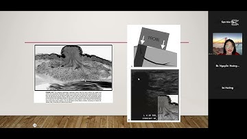 Bài 13 - Kỹ thuật siêu âm vú - BSNT. Hồ Thị Ánh Hiền