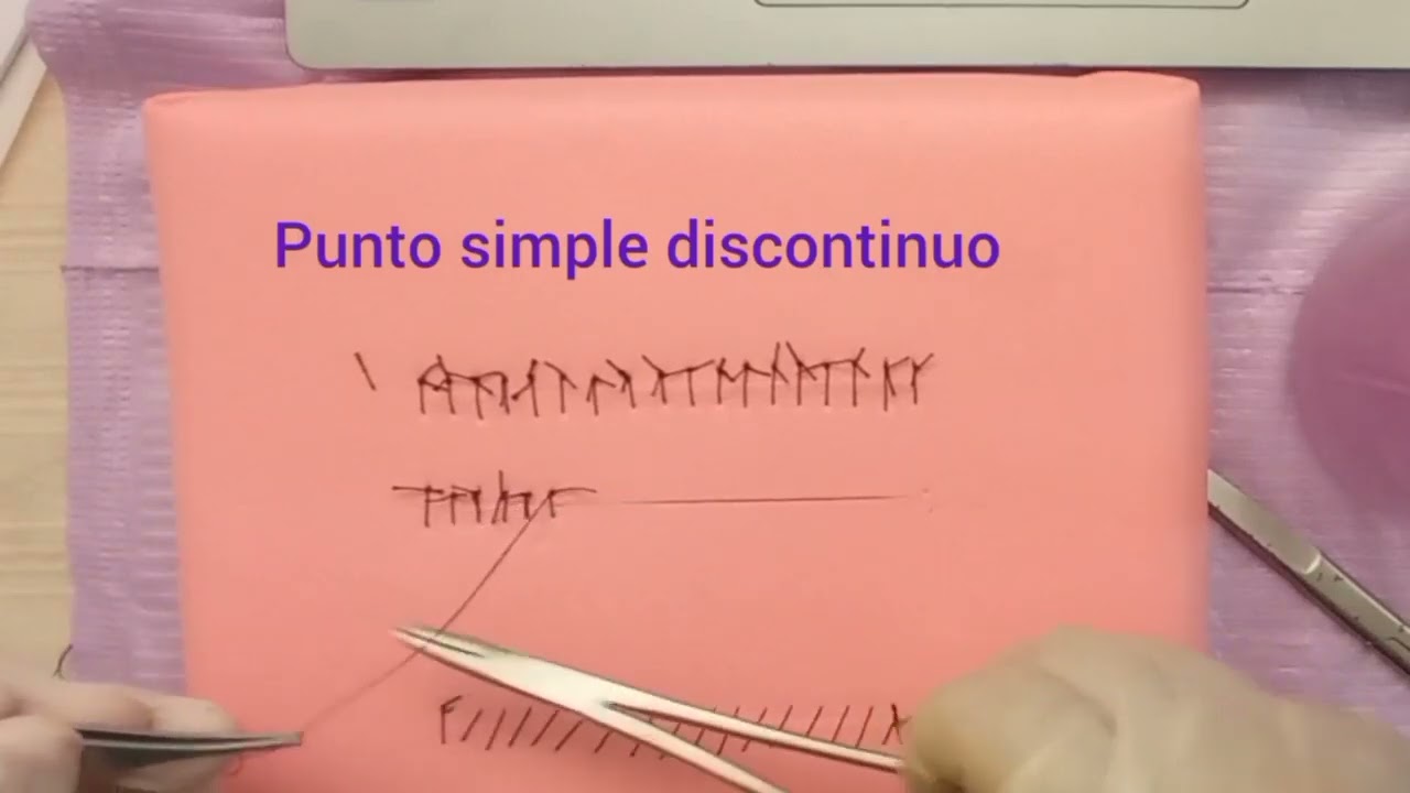 Punto Simple Discontinuo
