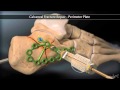 Calcaneal fracture perimeter plate