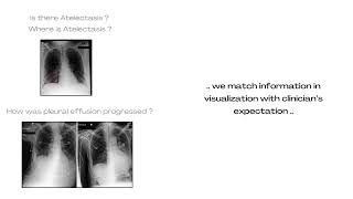 Enabling Multi-modal Conversational Interface for Clinical Imaging