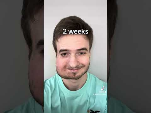 Surgery Recovery Timelapse