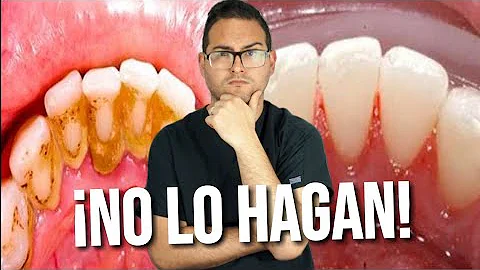 ¿Cómo se elimina la placa dental?